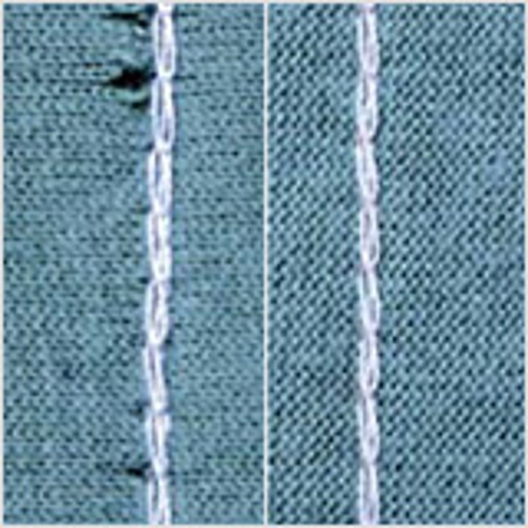 Special application needles SAN® 10 and SAN® 10 XS | Groz-Beckert KG